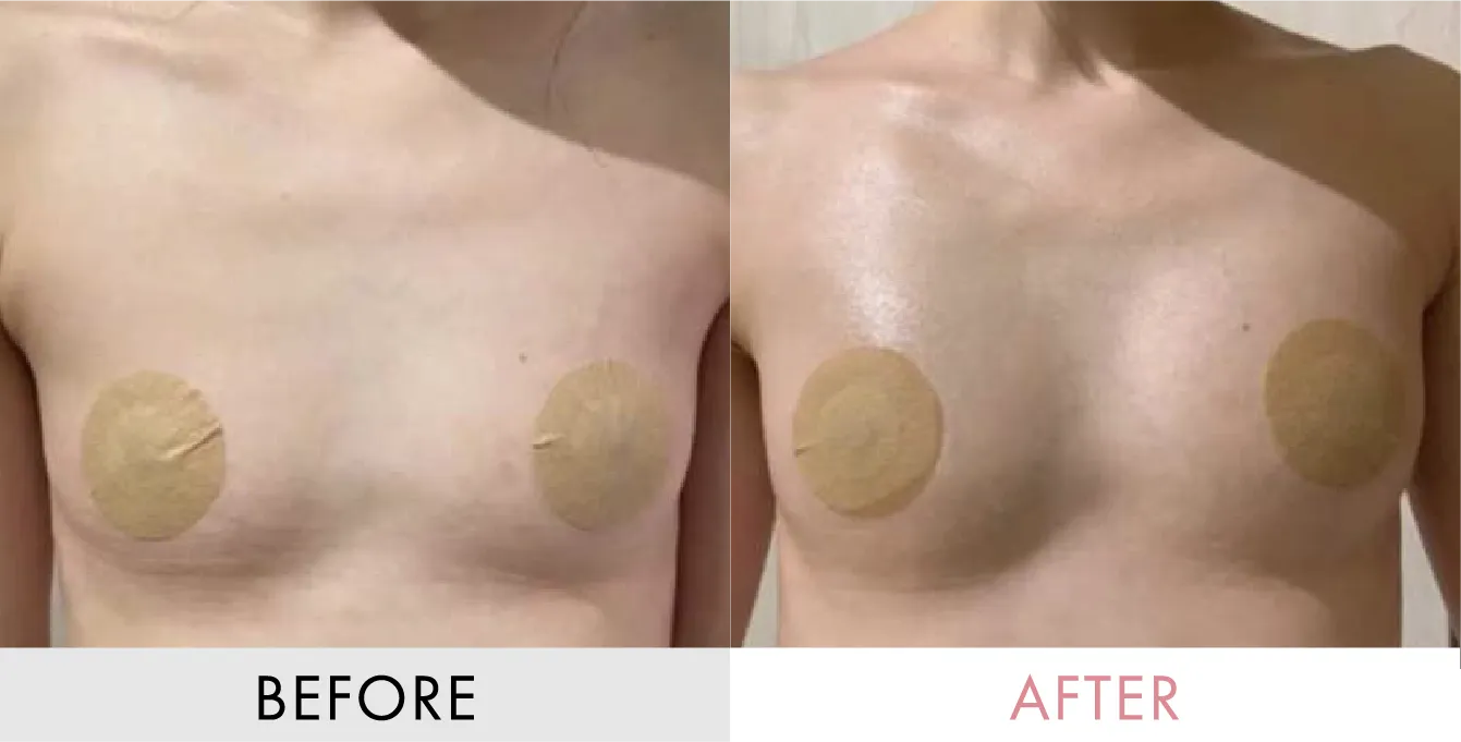 ビフォーアフターの画像