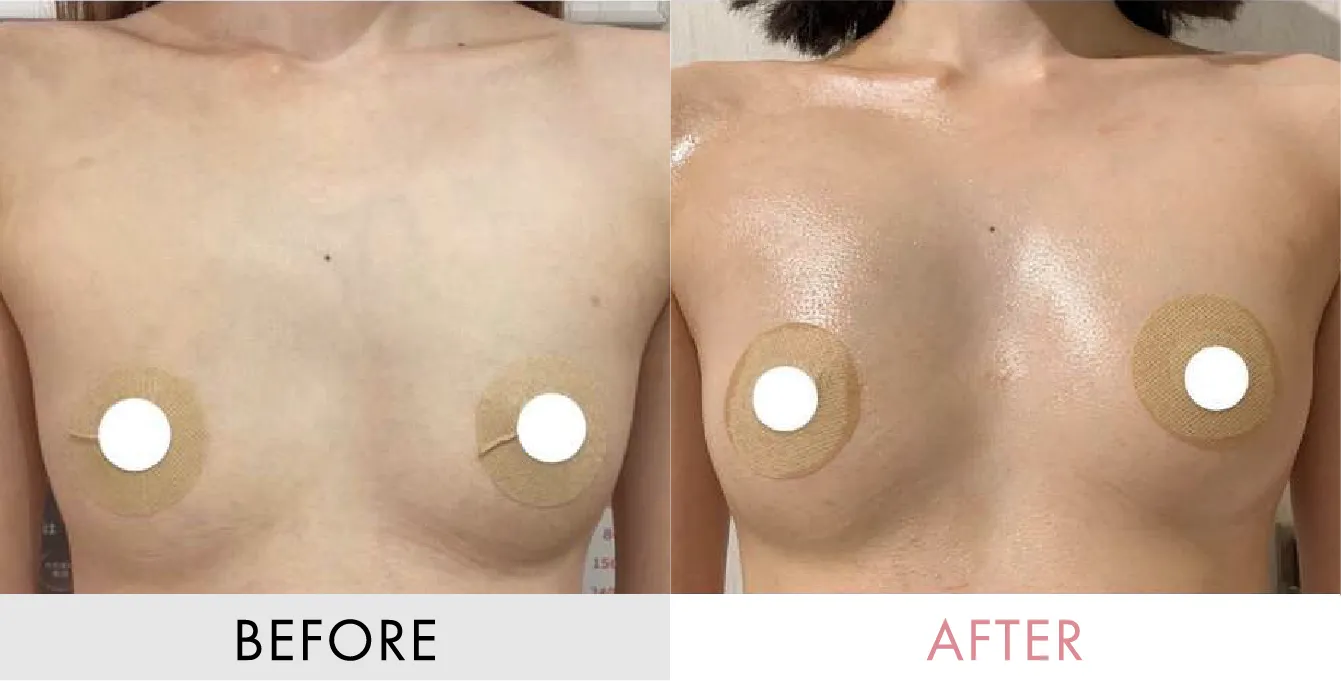 ビフォーアフターの画像