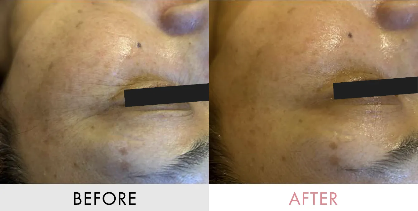 ビフォーアフターの画像