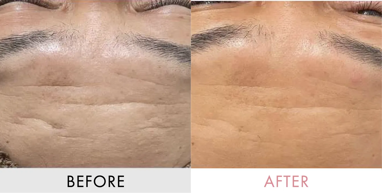 ビフォーアフターの画像